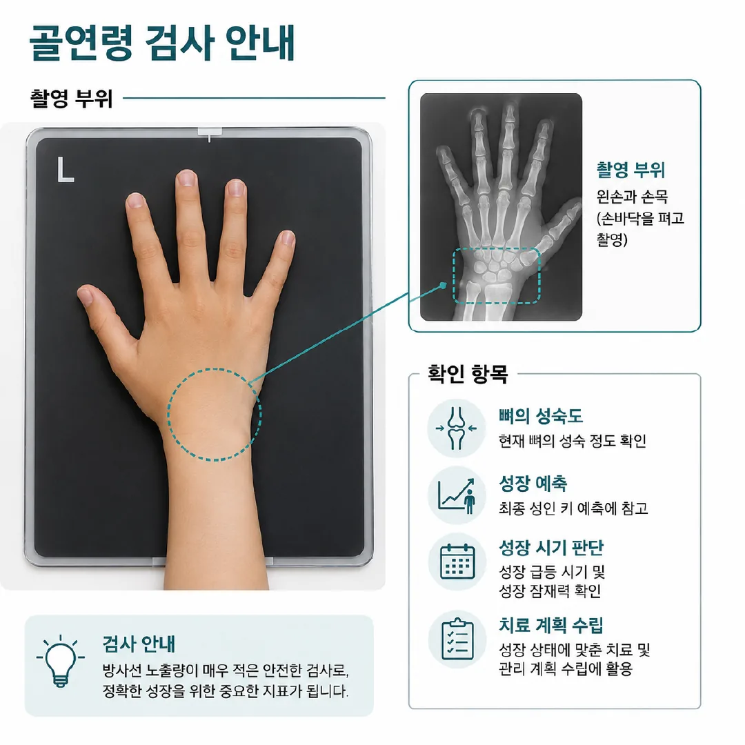 골연령 검사에서 촬영하는 왼손과 손목 부위 및 확인 항목을 표시한 그림